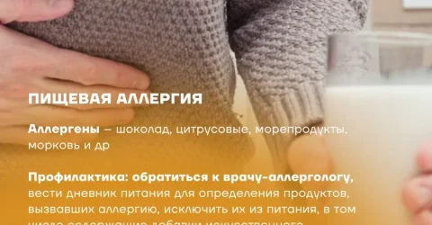 Аллергия (4)